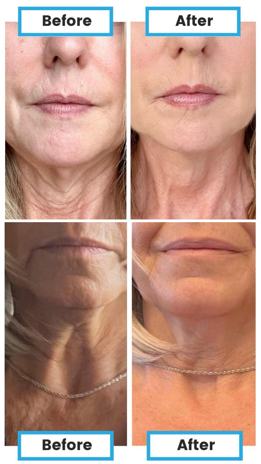 بخاخ نيومي للبشرة Neumi Skin Care بتقنيات النانو 
