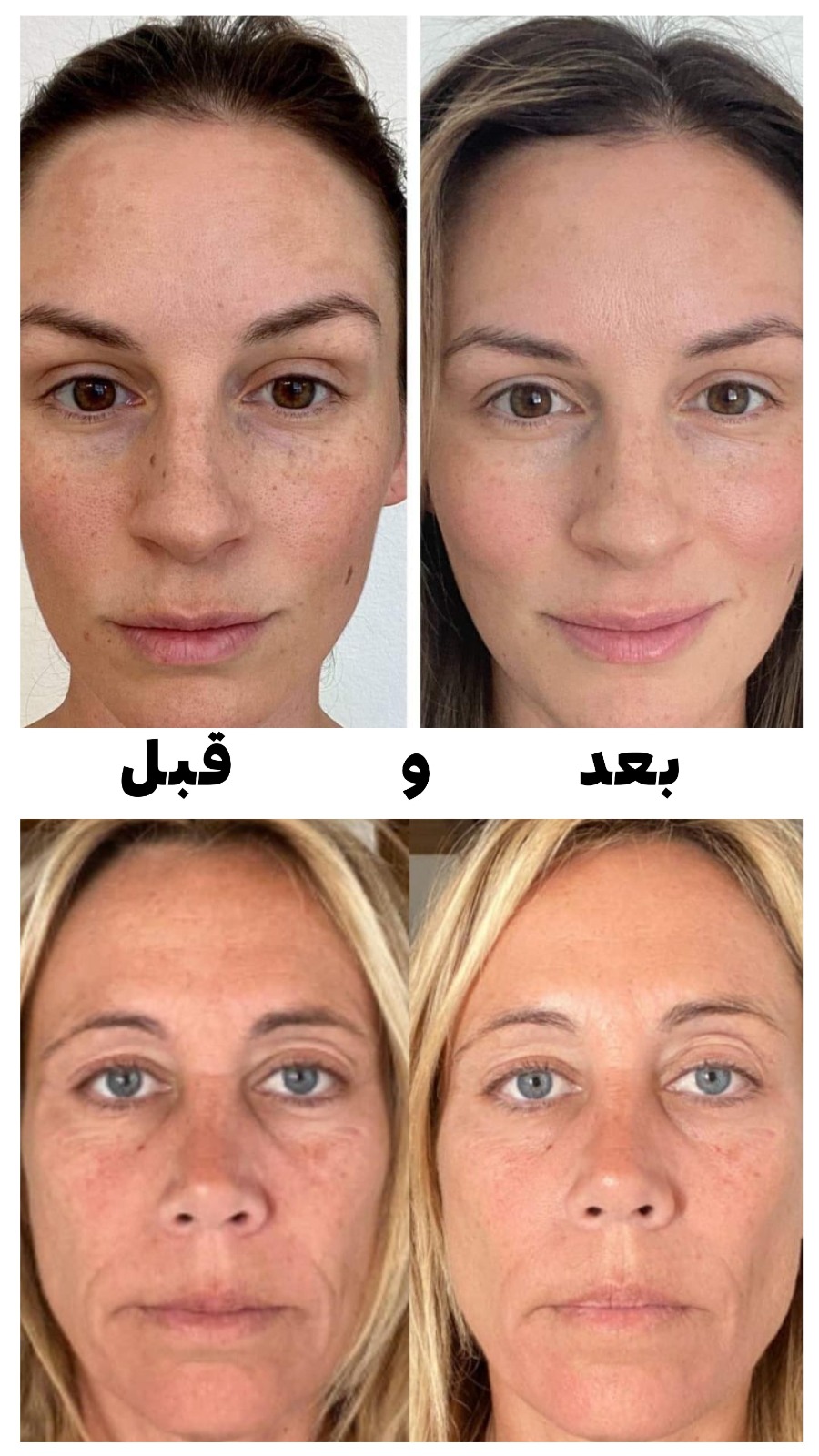 بخاخ نيومي للبشرة Neumi Skin Care بتقنيات النانو 