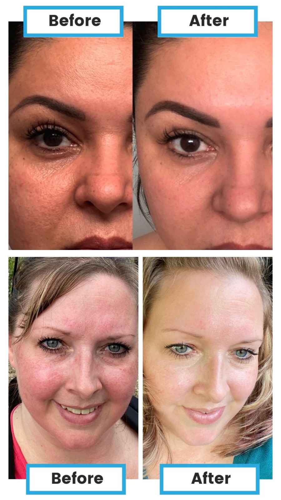 بخاخ نيومي للبشرة Neumi Skin Care بتقنيات النانو 